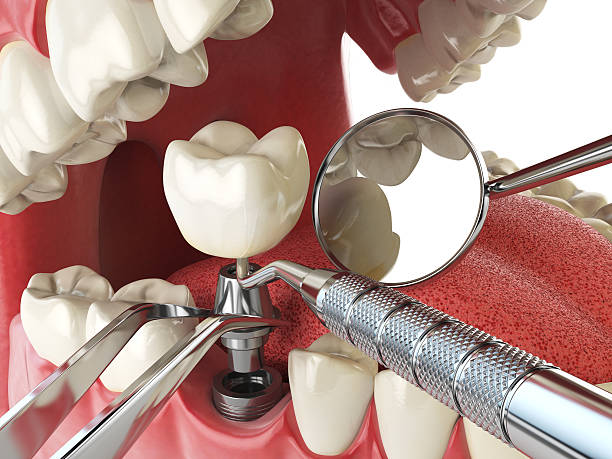 Best Emergency Treatment for Dental Infections or Abscesses in Christiana, TN