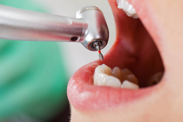 Best Emergency Dental Care for Broken or Chipped Teeth in Christiana, TN
